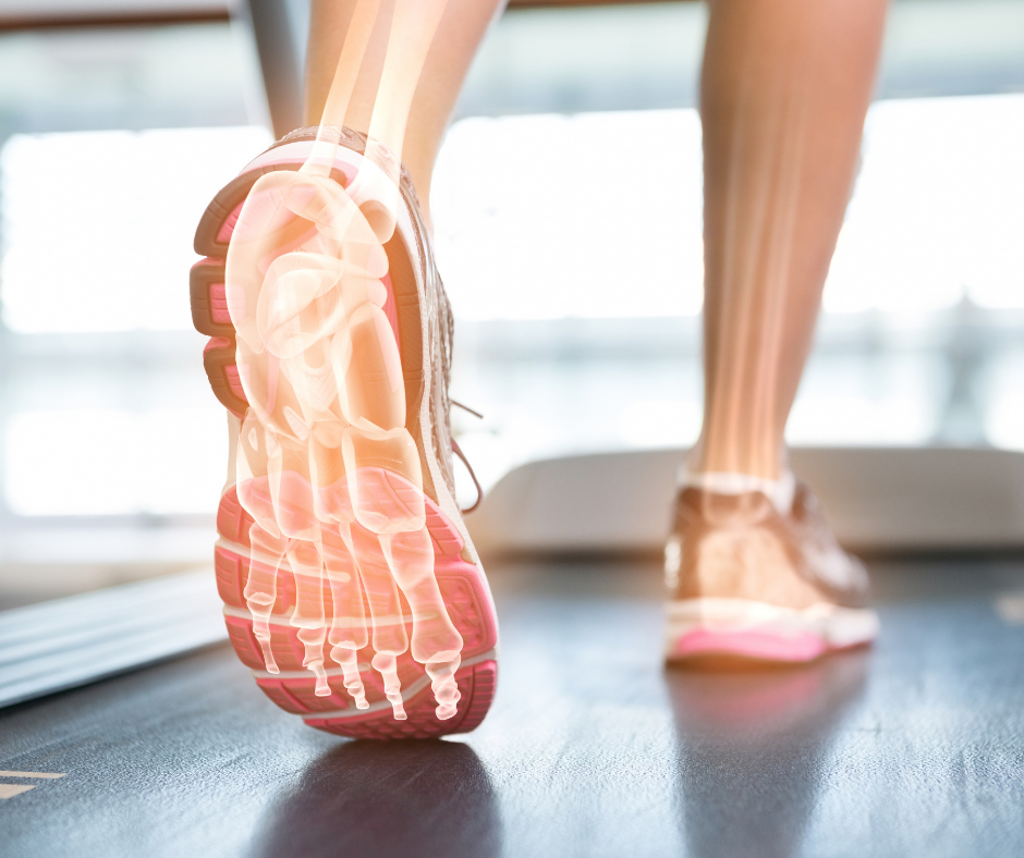 foot on treadmill x-ray
